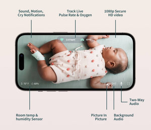 Owlet Dream Duo 2 Smart Baby Monitor - Includes FDA-Cleared Dream Sock & HD Video Wifi Camera!! LIGHTLY USED, TESTED WORKS GREAT(MISSING CORD BLOCK)!!